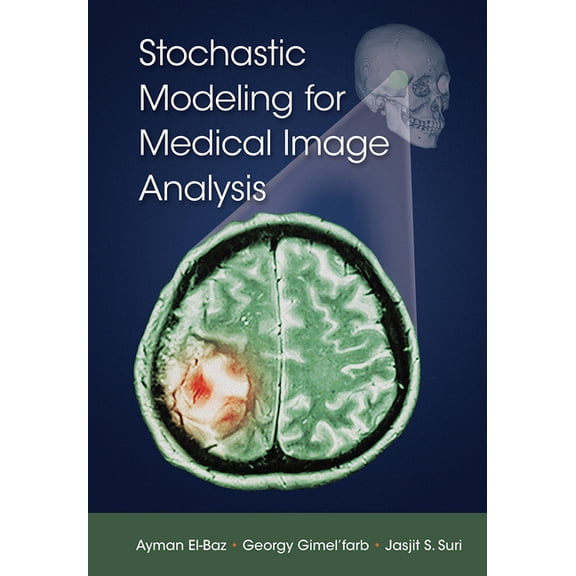 Stochastic Modeling for Medical Image Analysis, (Paperback)