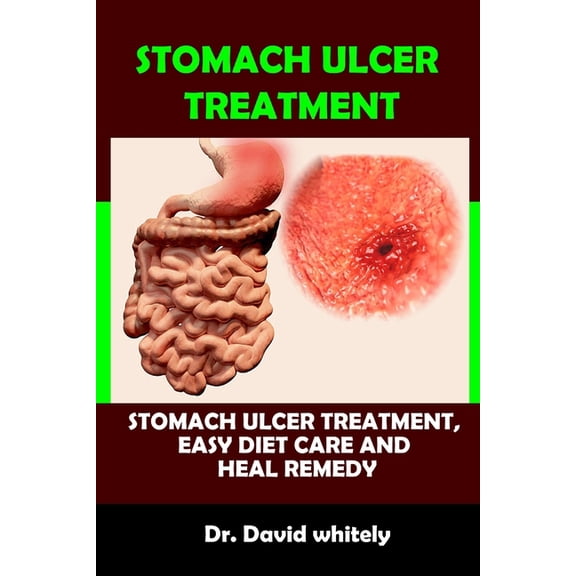 Stomach Ulcer Treatment: Stomach Ulcer Treatment, Easy Diet Care And Heal Remedy (Paperback) by Dr. David Whitely