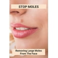thumbnail image 1 of Stop Moles: Removing Large Moles From The Face: Surefire Way To Get Rid Of Moles, (Paperback), 1 of 1