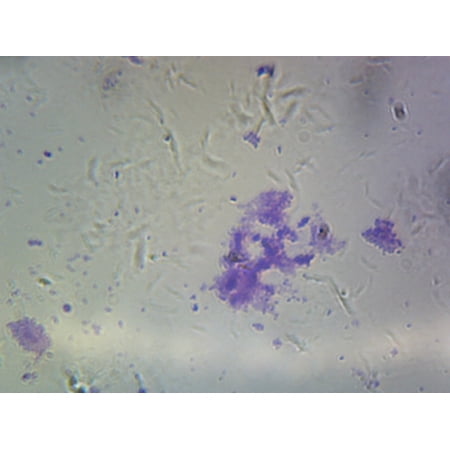 Streptococcus Pneumoniae (Diplococcus); Smear; Gram-Positive by Go Science Crazy