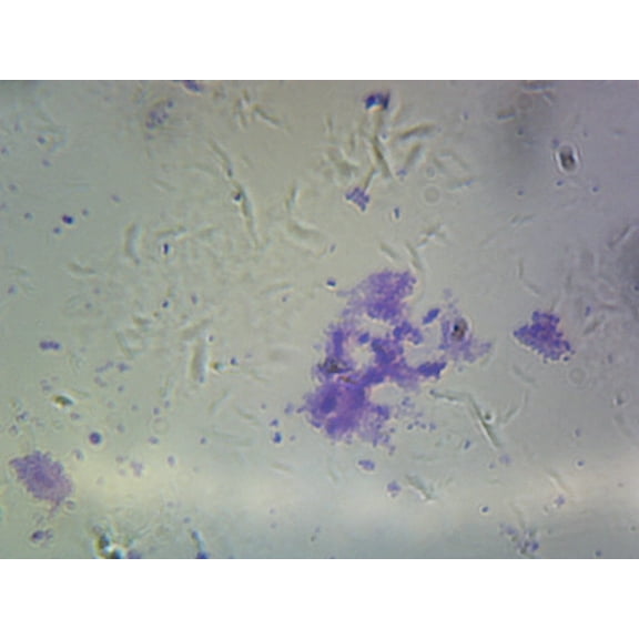 Streptococcus Pneumoniae (Diplococcus); Smear; Gram-Positive by Go Science Crazy