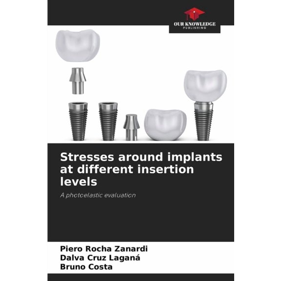 Stresses around implants at different insertion levels, (Paperback)
