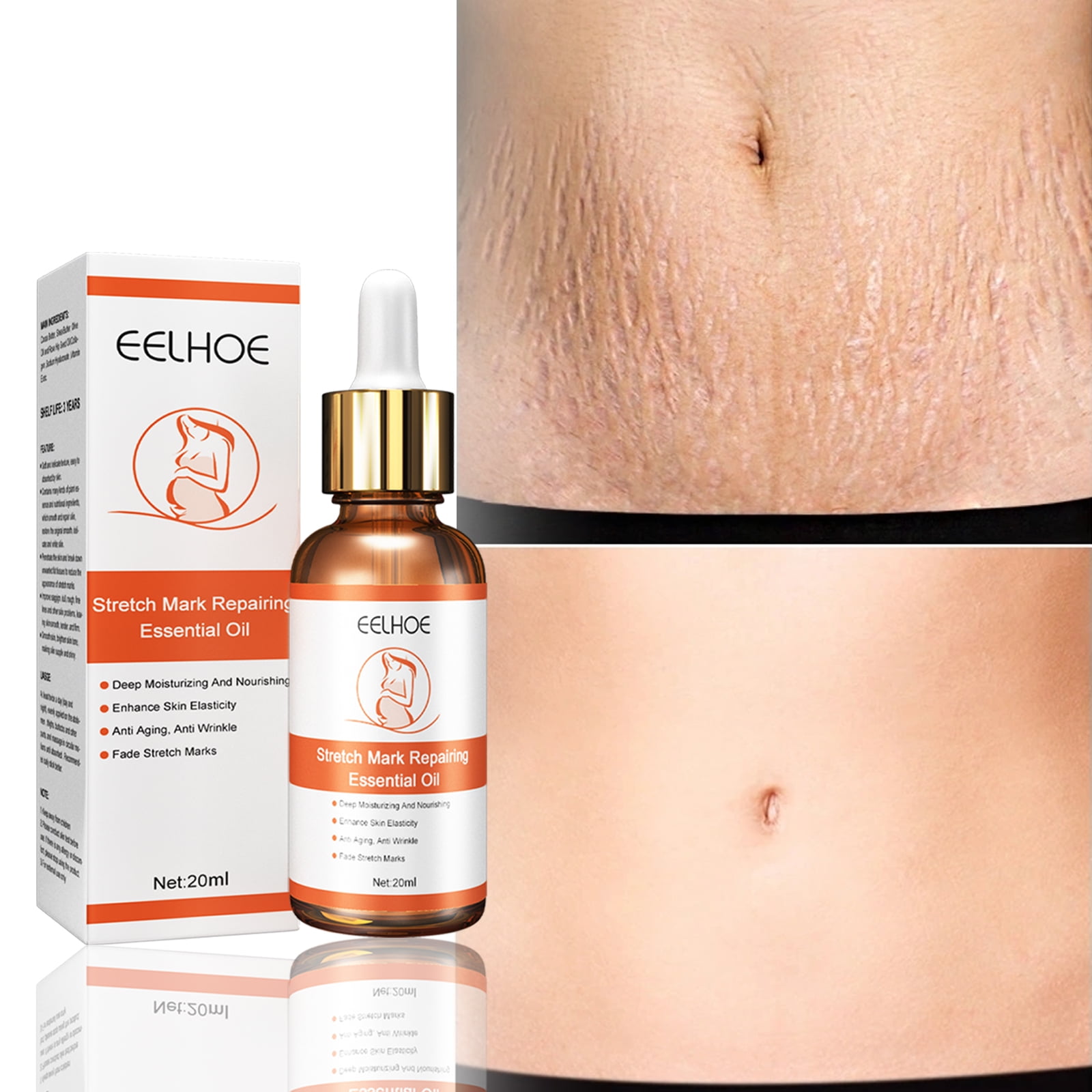 Stretch Mark Repair Essential Oil Scar Cream Stretch Mark Removal