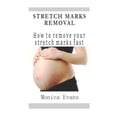 thumbnail image 1 of Stretch Marks Removal: How to remove your stretch marks fast (Paperback) by Monica Evans, 1 of 1