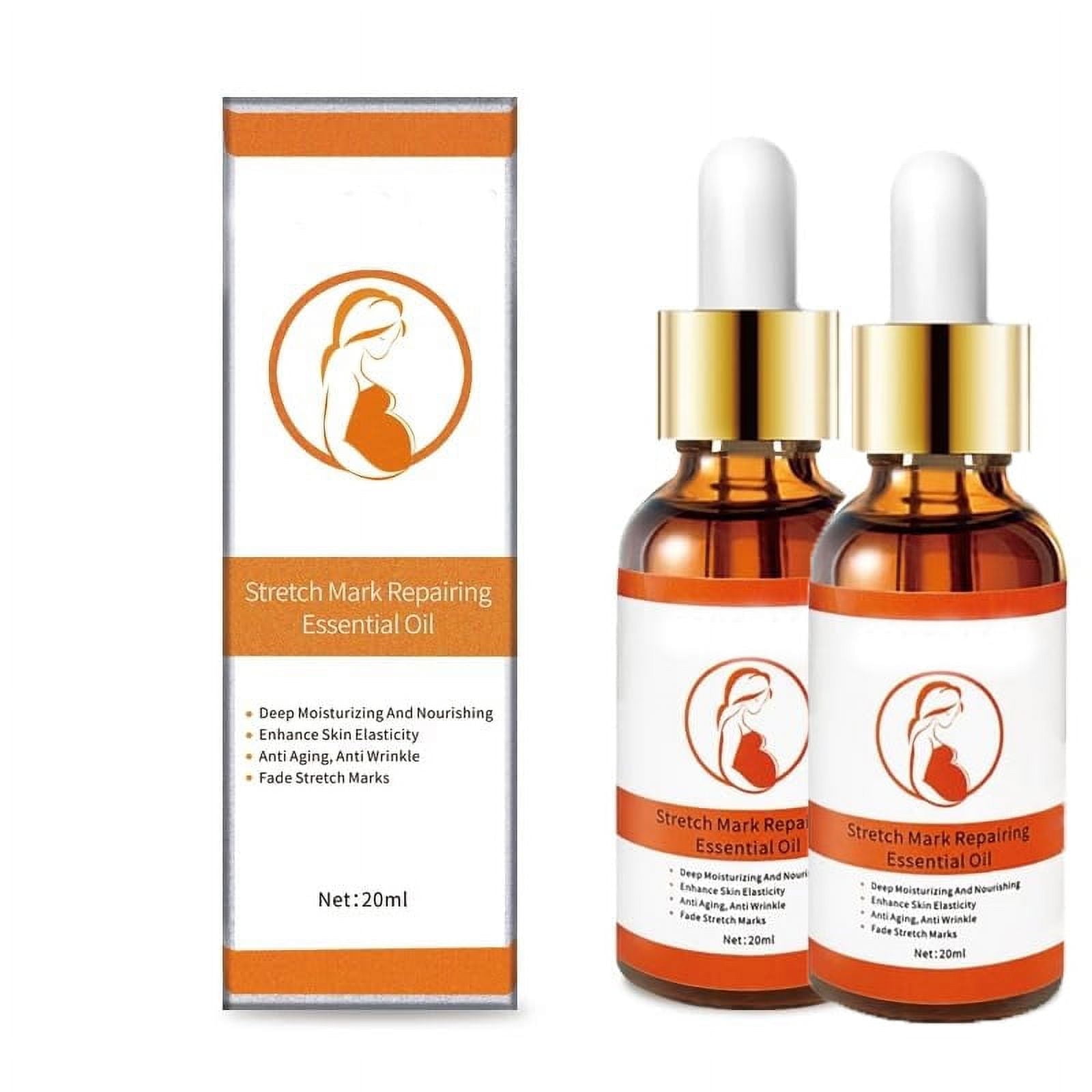 Stretch Marks Remover Essential Oil Skin Care Treatment Cream For