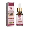 Stye Eye Treatment, Chalazion Remover Fast Relief Serum For Eye