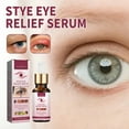 Stye Eye Treatment, Stye Eye Serum for Styes Chalazion and Blepharitis