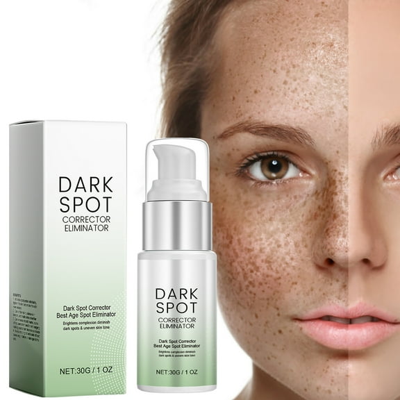 Suitable For Face And Body Age Spots And Freckles Dark S-pot Corrector 30g