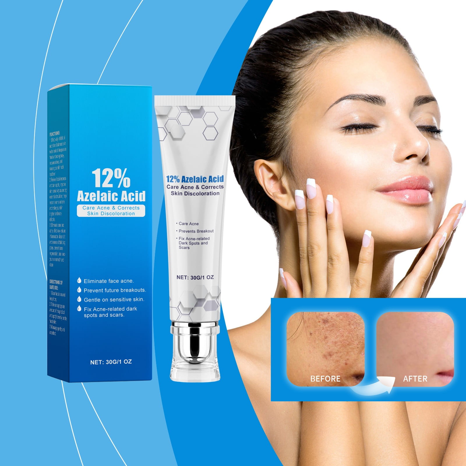 Sumllary Azelaic Removing Face Moisturizing And Oil Controlling