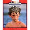 thumbnail image 1 of Pre-Owned Sunburn (Paperback) 0516268732 9780516268736, 1 of 1