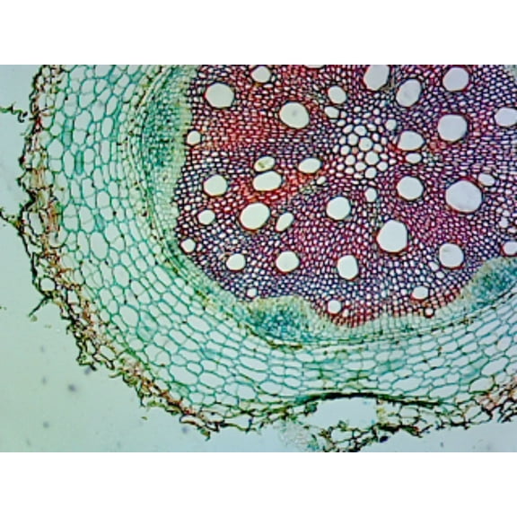 Sunflower (Helianthus) Stem; Typical Monocot Stem; Cross Section by Go Science Crazy
