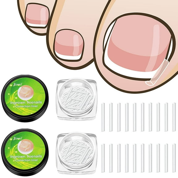 Sunjoy Tech Ingrown Toenail Filling Pads, Toenail Correction Patches, Curved Toenails Straightening Recover Clips, Thick Paronychia Pedicure Tool Toenail Straightener Strips