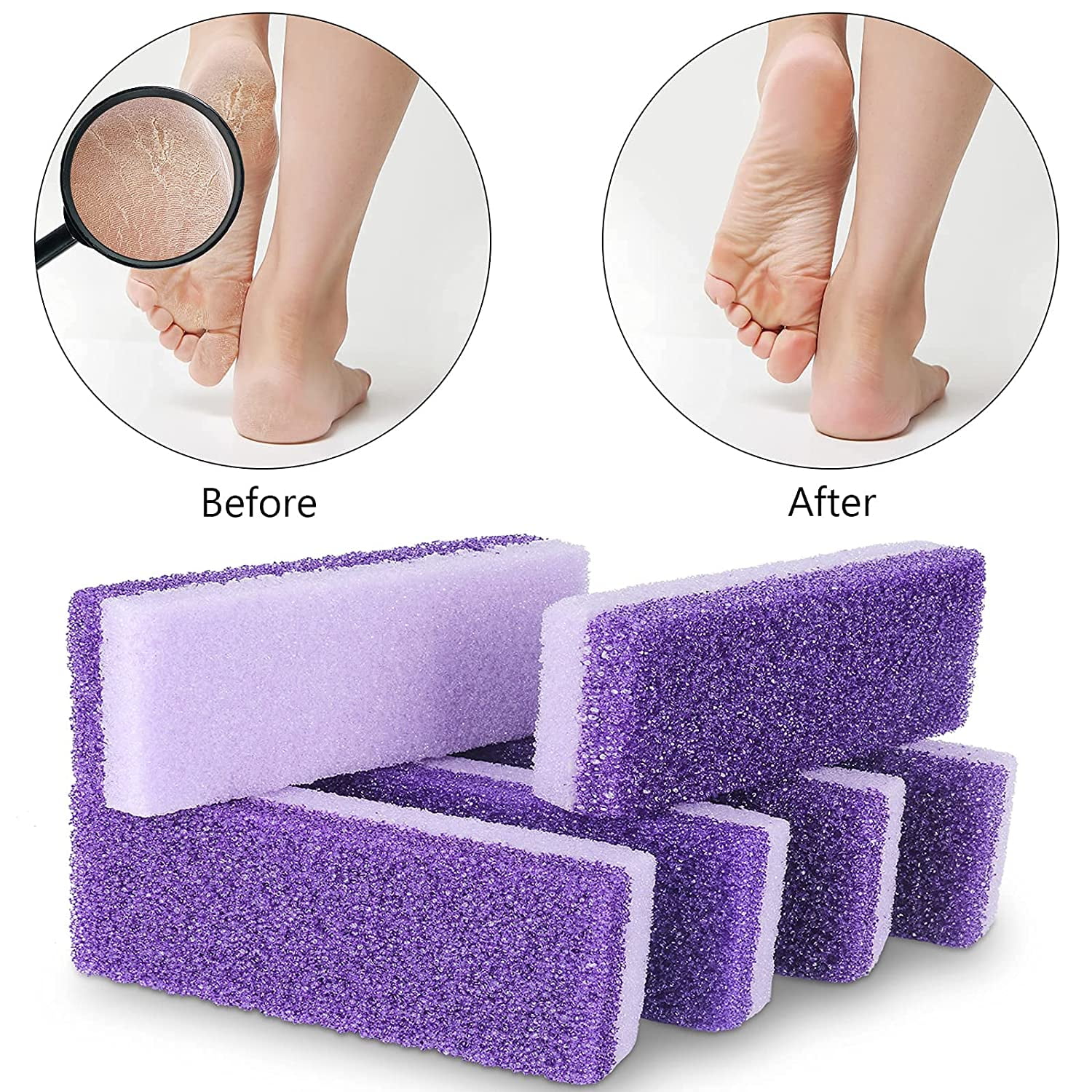 Sunjoy Tech Pumice Stone for Feet Ultimate 2in1 Scrubber and