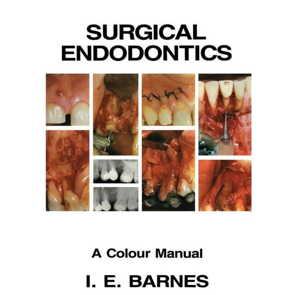 Surgical Endodontics: A Colour Manual, (Paperback)