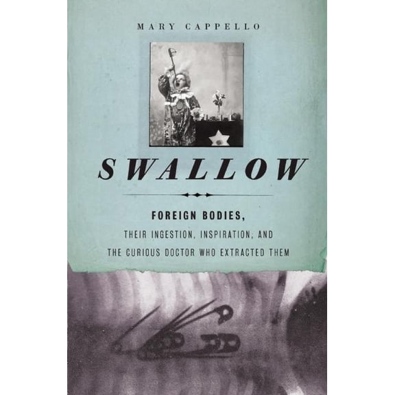 Swallow: Foreign Bodies, Their Ingestion, Inspiration, and the Curious Doctor Who Extracted Them, (Hardcover)