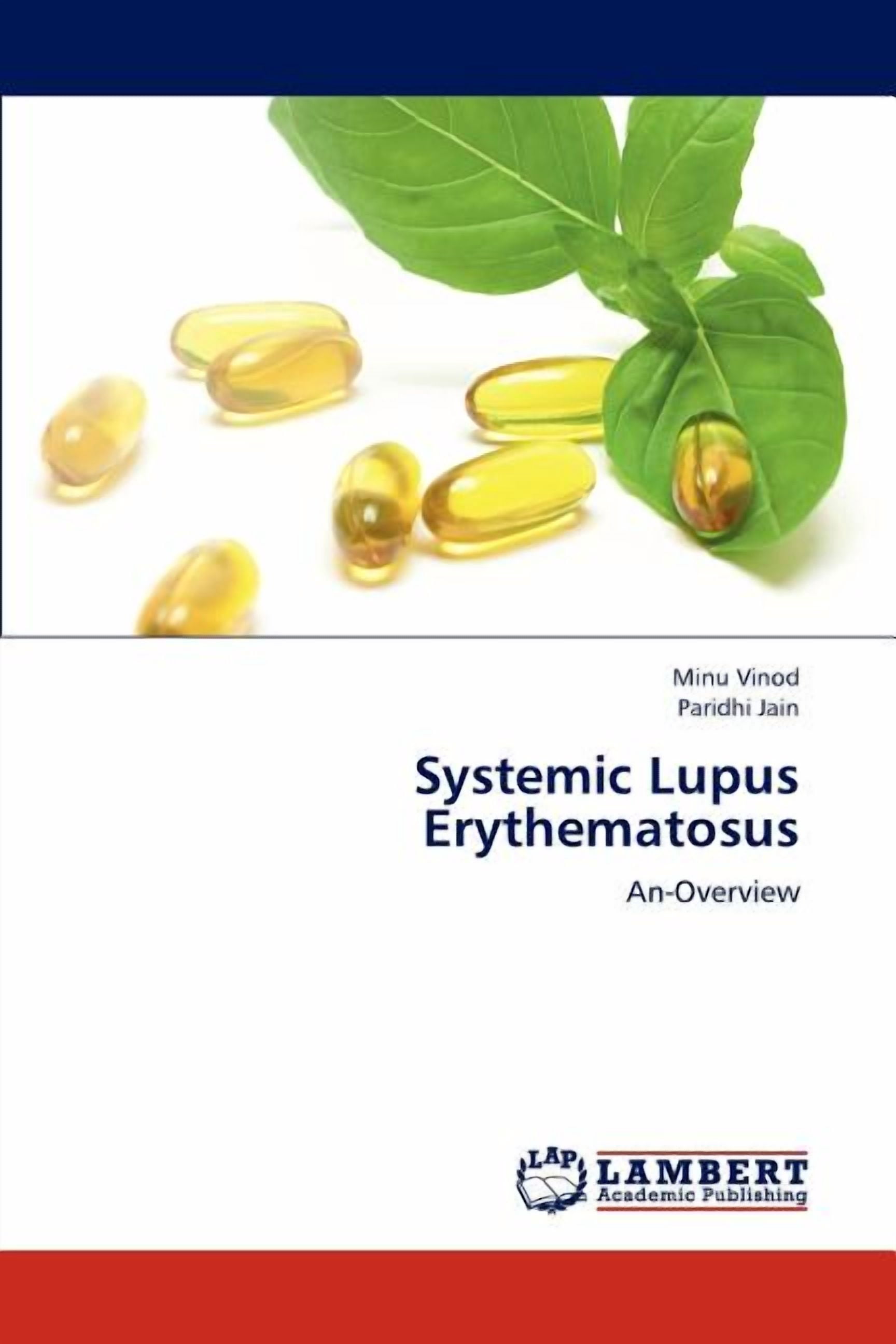Systemic Lupus Erythematosus (Paperback) - Walmart.com