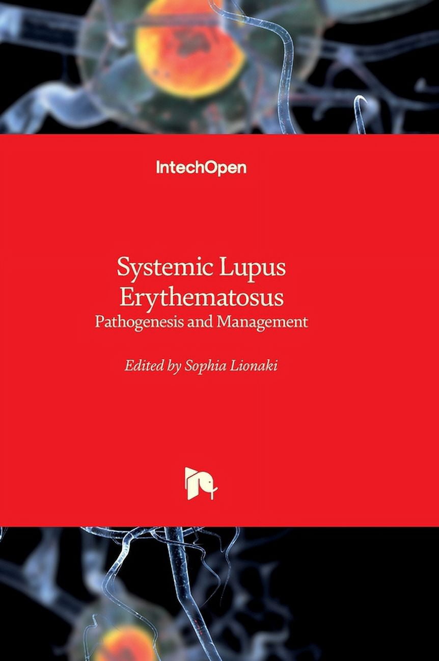 Systemic Lupus Erythematosus - Pathogenesis and Management, (Hardcover ...