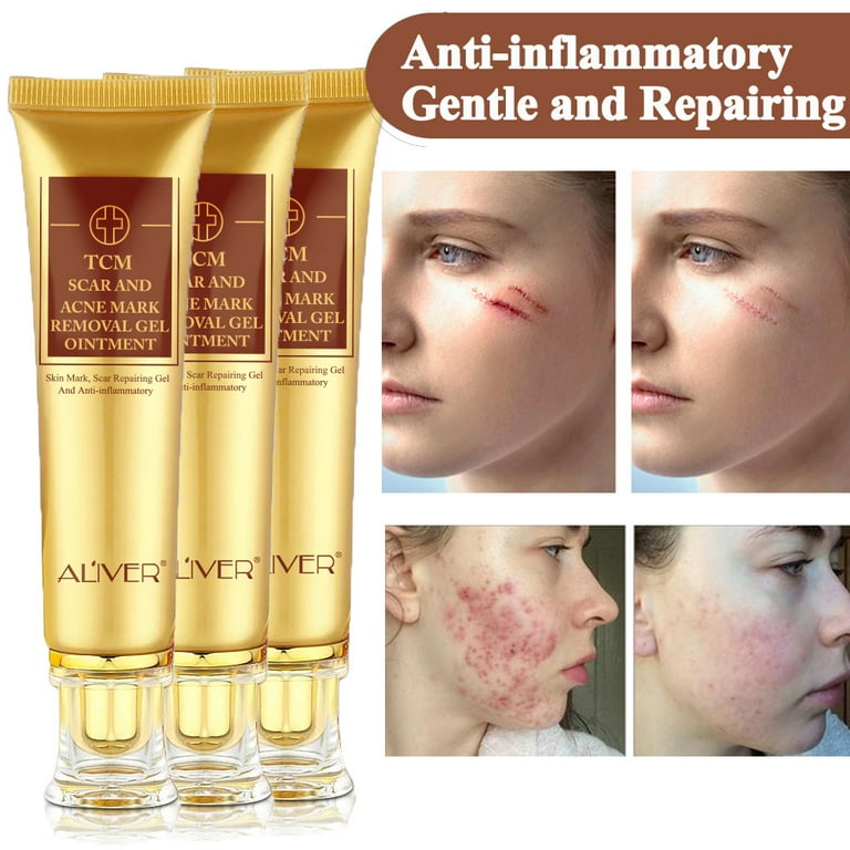 Tcm scar and cheap acne removal gel