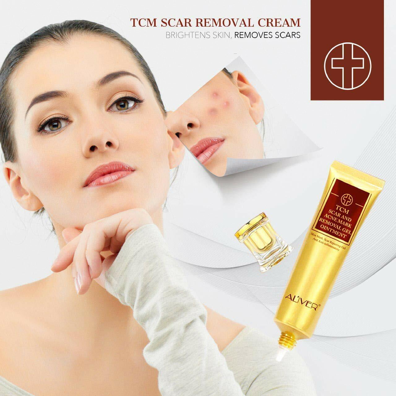 TCM Scar Acne Removal Gel Ointment Stretch Marks Old Scars Burns Repair