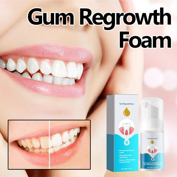 TUITOONM Gums Regrowth Foam 30ml Natural Gum Tissue Repair Formula, Reduces Receding Gums & Strengthens Tooth Attachment, Soothes Inflammation for Healthier Smile