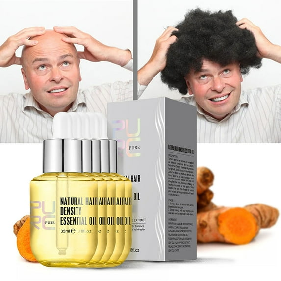 TUTUnaumb Ginger Hair Nutrition Liquid, Ginger Health Liquid, Plant Nourishing And Hair Care Essential Oil, Dense Hair Essential Oil 175ml-B