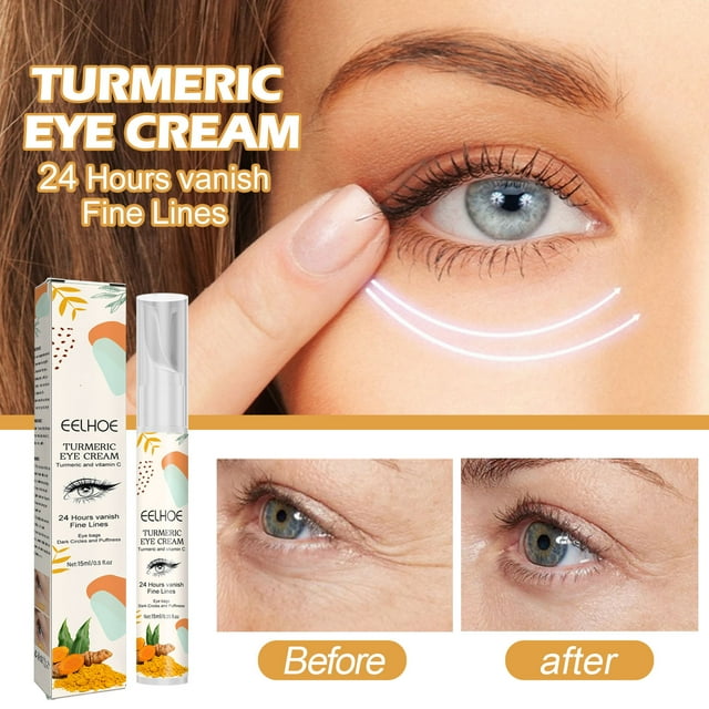 TUTUnaumb Turmeric Eye Cream, Suitable For Around The Eyes, To Prevent