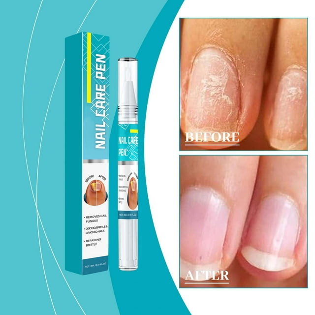 TYTSPEASY Nail Foot And Hand Grey Nail Pen Soft Nail Thick Nail Solution 3ML Acrylic Nails