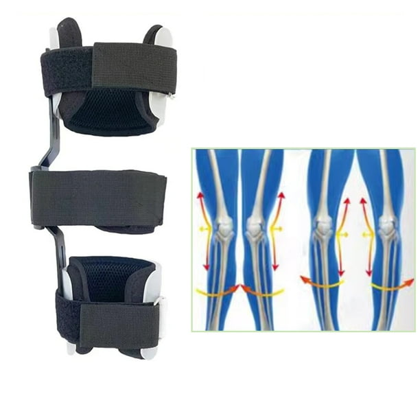 Tairbousy 1 Pair O X Leg Type Correction Belt Pediatric Kids Leg Posture Corrector Brace for Children