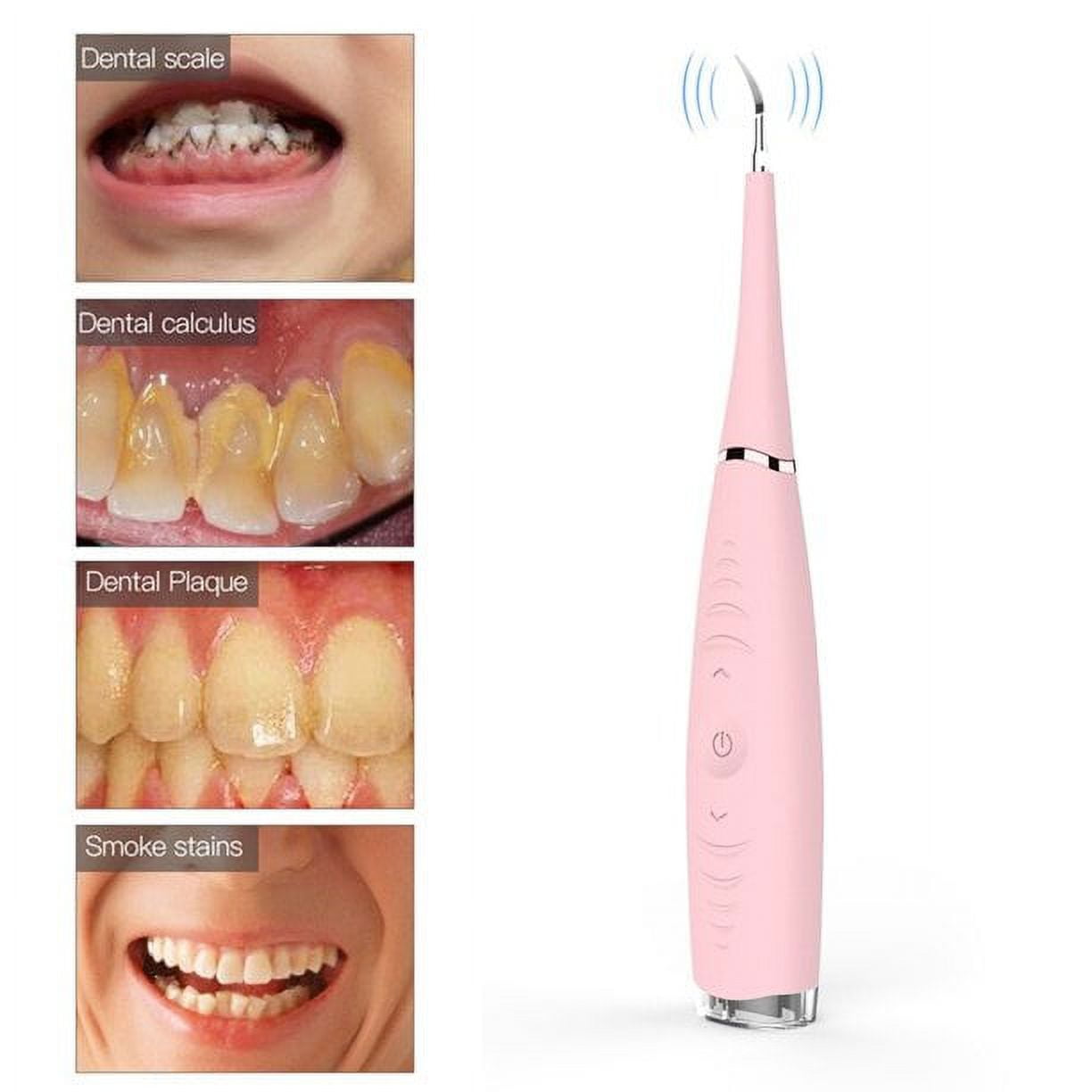 Dental calculus remover discount