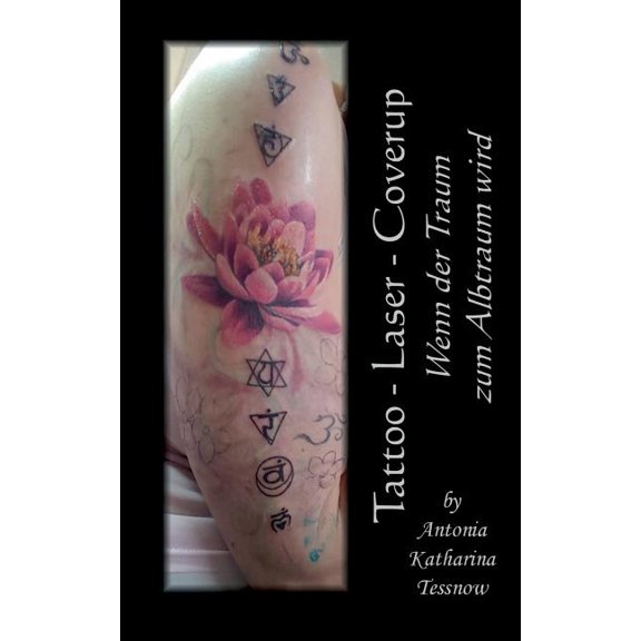 Tattoo - Laser - Cover Up: Wenn der Traum zum Albtraum wird, (Paperback)
