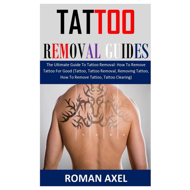 Tattoo Removal Guide The Ultimate Guide To Tattoo Removal How To