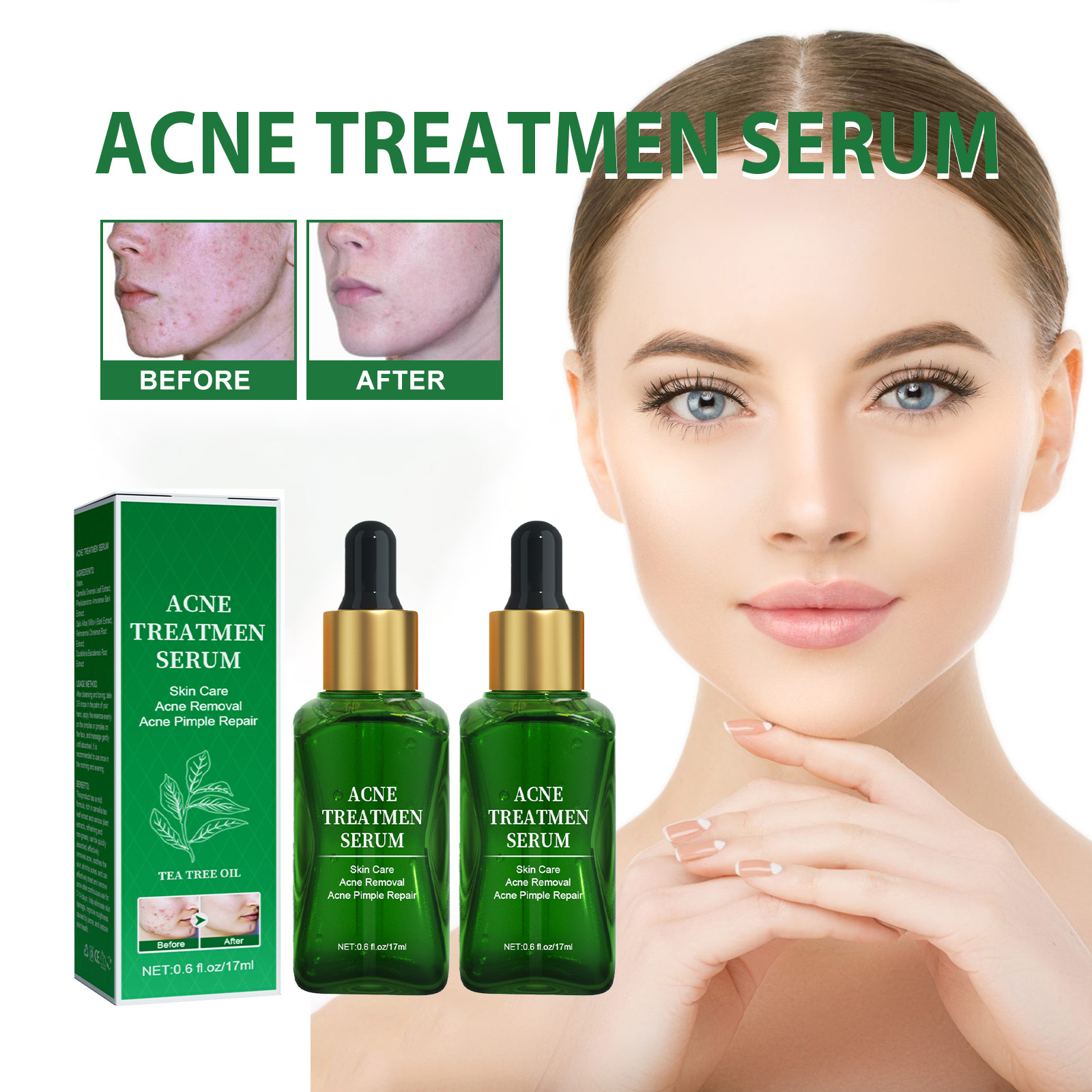 Tea Tree Oil Acne Serum,Treatment Acne Prone Sensitive Skin Care Face
