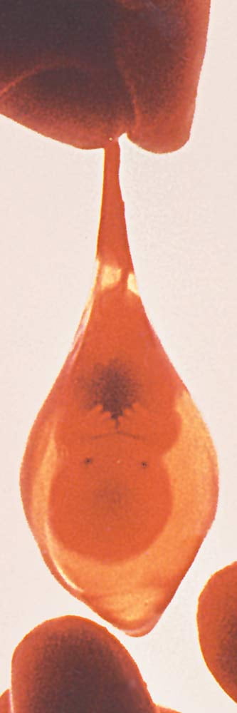 Teardrop Pro-Life Bookmark (Pack of 100)