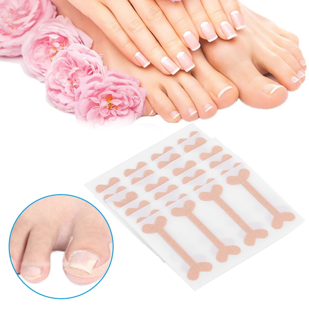 Tebru 24pcs Ingrown Toenail Correction Bandage Paronychia Treatment