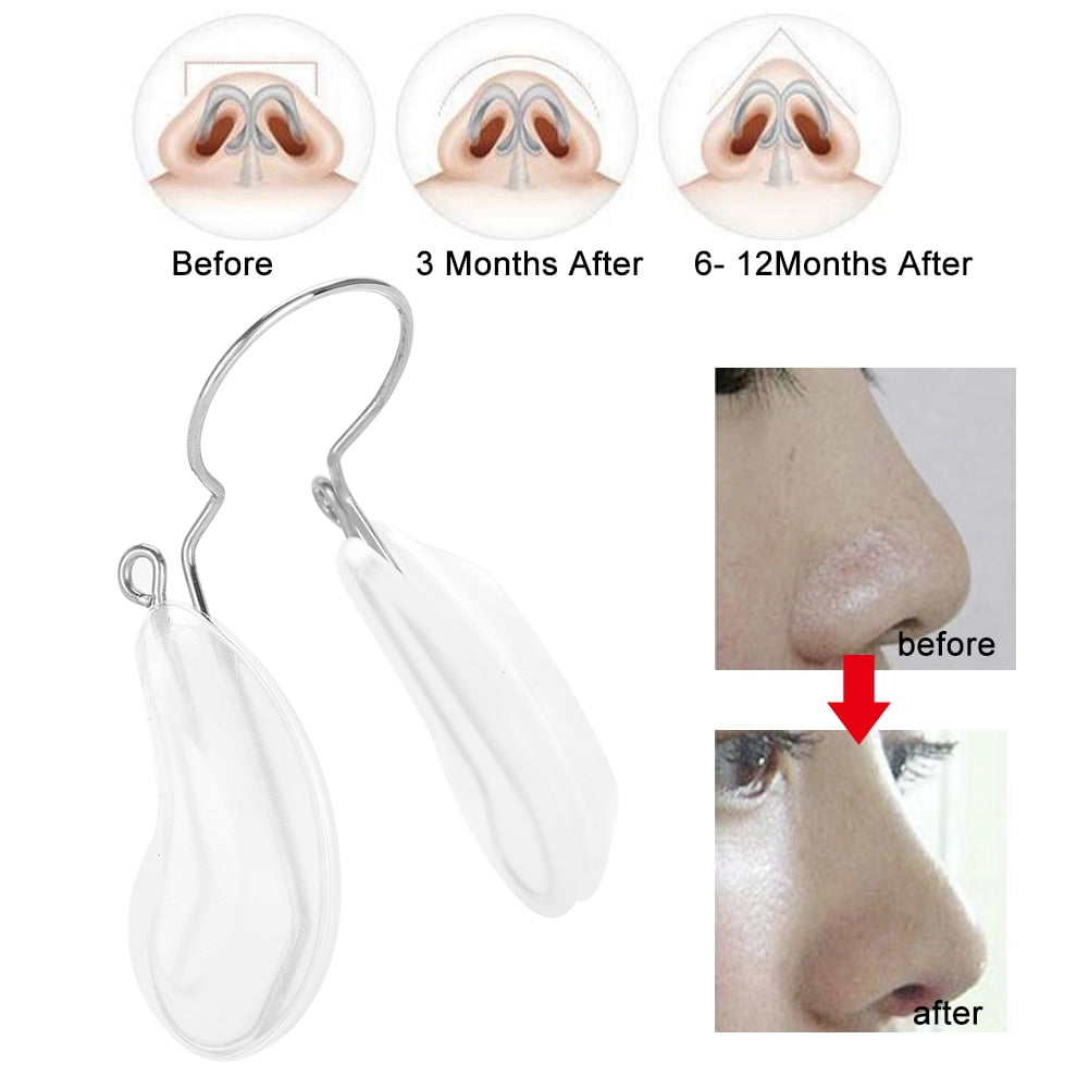 Tebru Nose Up Shaping Lifting Straightening Clip Bridge Beauty Enhancer  Reshaper White, Nose Shaping Clip, Nose Shaper