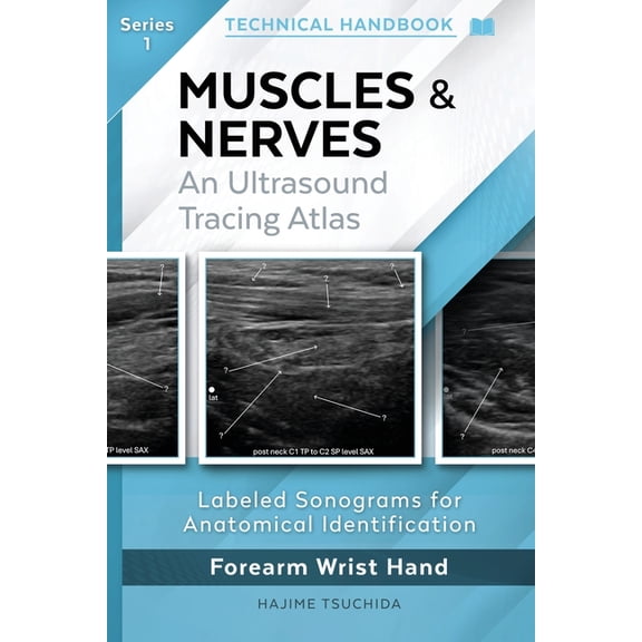 Structured Approach MUSCLES & NERVES - Technical Ultrasound Handbook of the Forearm, Wrist and Hand (Series 1): An Ultrasound Tracing Atlas, Book 1, (Paperback)