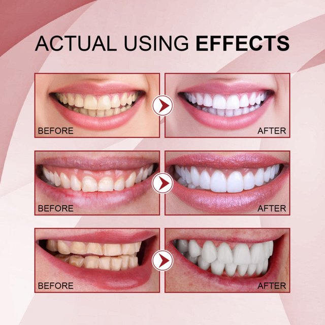 Teeth Brightening Stains Removal Toothpaste Multipurpose White