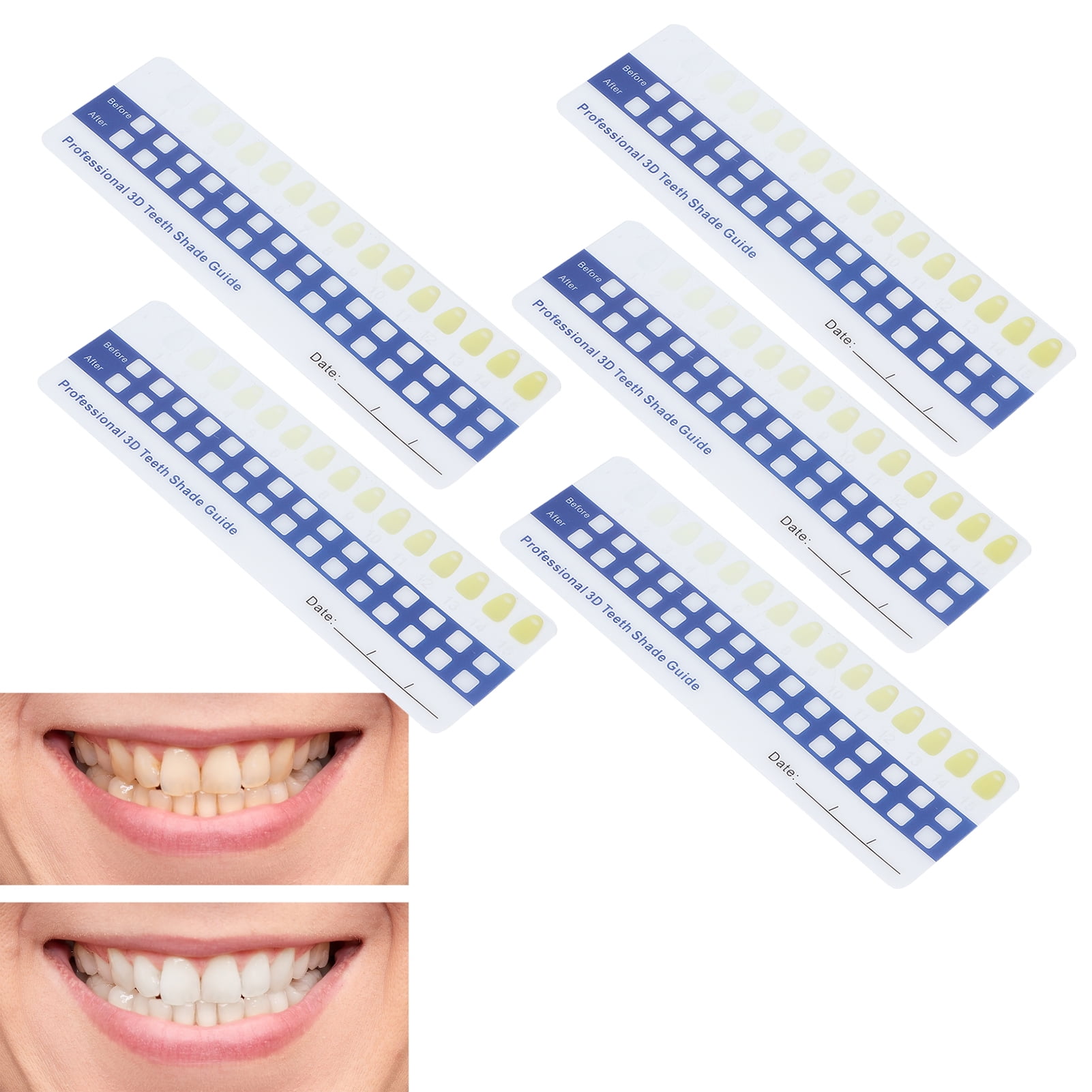 Teeth Shade Guide, Teeth Color Chart Professional Color Comparing Eco Friendly Compact For Home