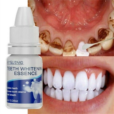 Teeth Whitening Essences Extra Strong White Hygiene Tooth Whitener Stain Removal,1pc