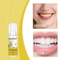 thumbnail image 1 of Teeth Whitening Mousse Foam,Teeth Whitening Toothpaste,Ultra-fine Mousse Foam Deeply Cleaning Gums,Oral Care-Toothpaste Replacement,Freshens Breath Supports Health Protects Tooth Enamel,60ml, 1 of 8