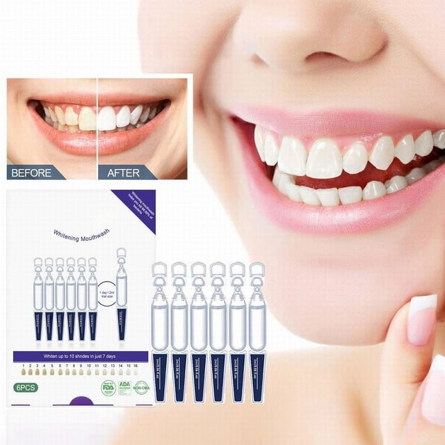 Teeth ning Pen Sensitive Teeth Teeth Retainer Hx9924 Plaque Buster for