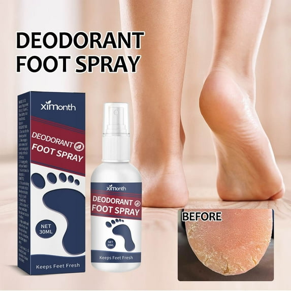 Teissuly Deodorant Foot Spray Keeps Fresh For Dry Crack Foot Odor 30ml