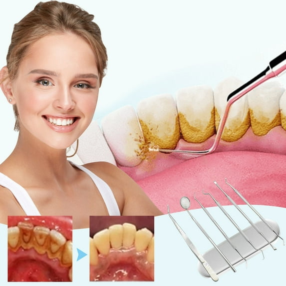 Teissuly Stainless Steel 6-piece Set To Assist The Use Of Tweezers, Mouth Mirror Probe Tool