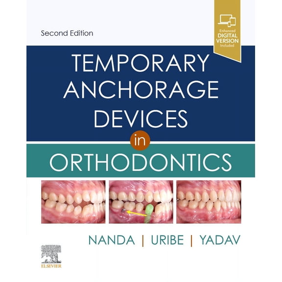 Temporary Anchorage Devices in Orthodontics