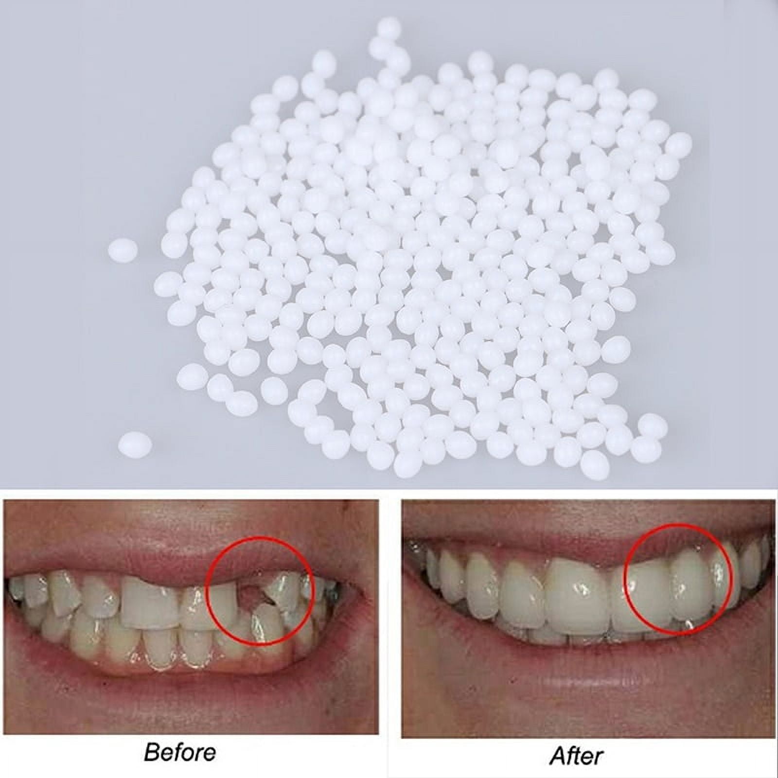  Tooth Repair Kit-Thermal Fitting Beads Granules and Fake Teeth  for Temporary Fixing Missing and Broken Tooth, Moldable Fake Teeth and  Thermal Beads Replacement Kit.【Teeth - White】 : Health & Household