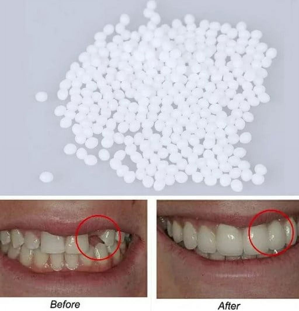 Amazing Teeth Repair Kit, Short-term Tooth Kit, Temporary Teeth
