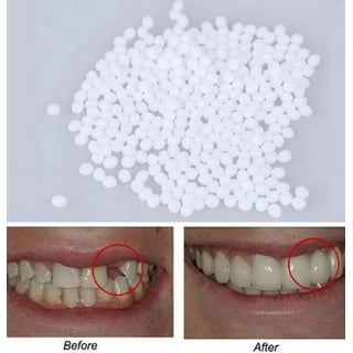 Tooth Repair Granules,Teeth Repair Kit, Moldable False Teeth, Thermal  Fitting Beads for Filling Fix The Missing and Broken Tooth Adhesive (10ml)