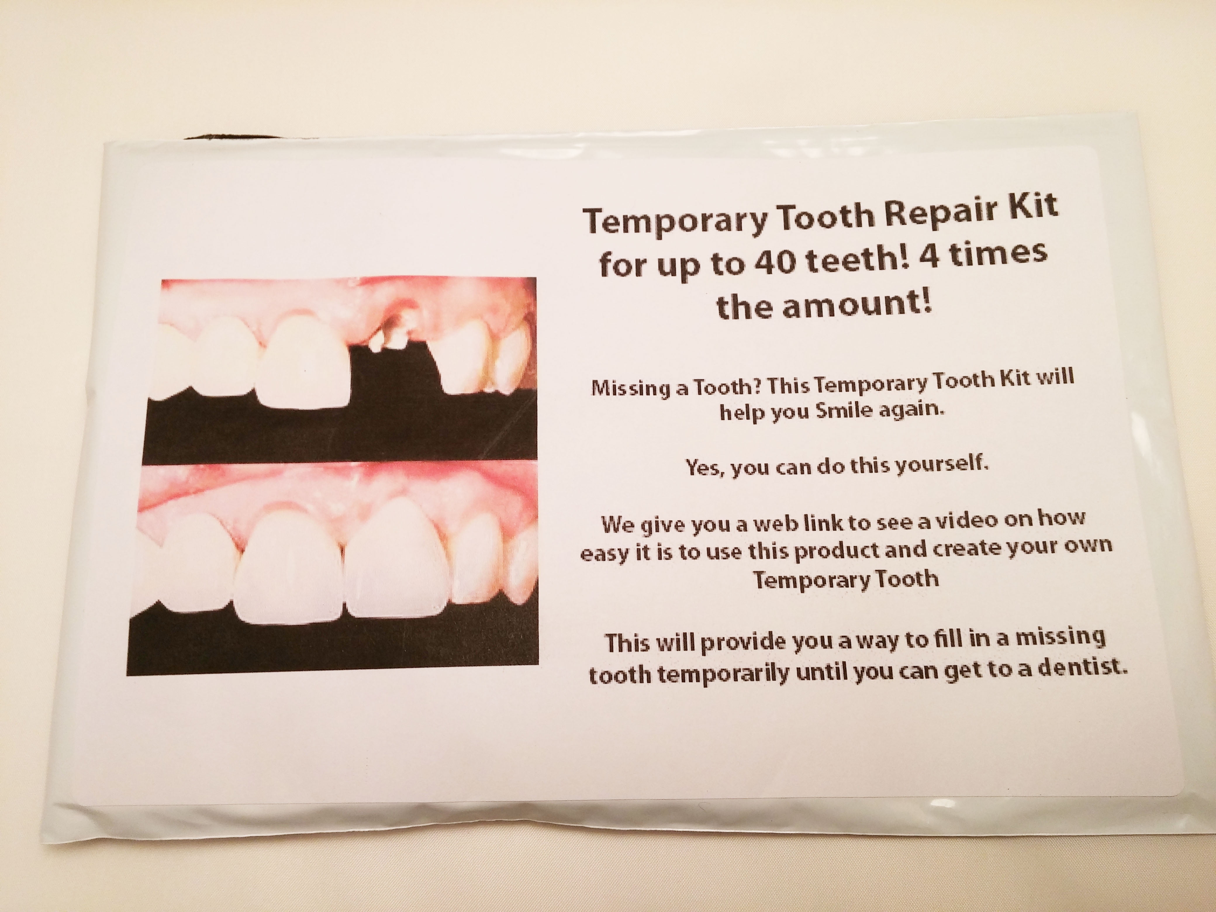 Temporary tooth repair kit dental fix missing up to 40 teeth! 4 times