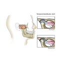 thumbnail image 1 of Temporomandibular joint  normal and dislocated. Poster Print by TriFocal Communications/Stocktrek Images, 1 of 2