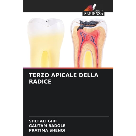 Terzo Apicale Della Radice, (Paperback)